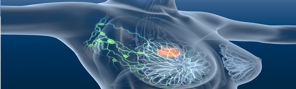 Masterclass Gemetastaseerd Mamma-Longcarcinoom - Stichting Oncowijs